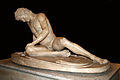 0 Galata Morente - Musei Capitolini (1).jpg